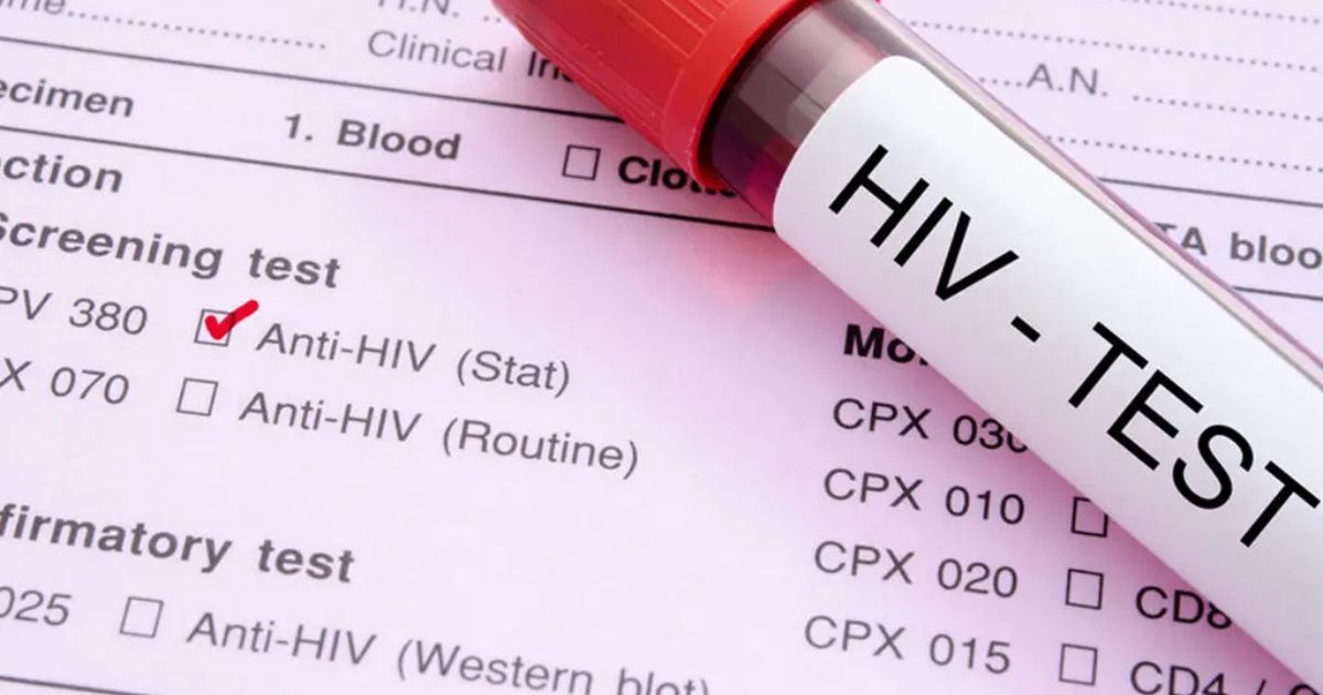 पश्चिमी सिंहभूम में HIV संक्रमण के बढ़ते मामले, सात महीने में 74 नए मरीज