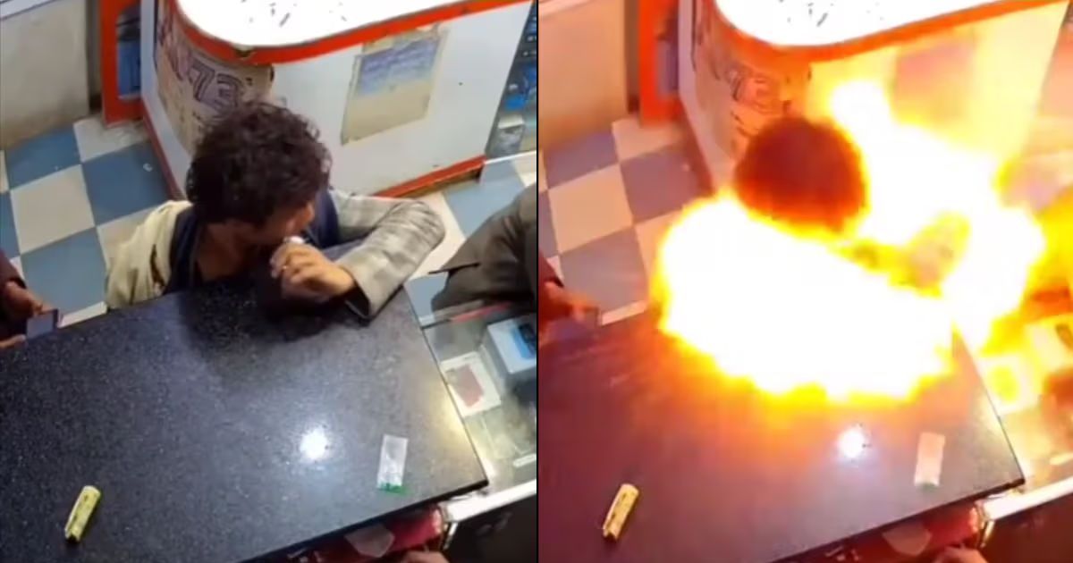 मुंह में दबाकर मोबाइल बैटरी चेक करना पड़ा भारी, जोरदार धमाके में शख्स हुआ घायल, देखें Video 